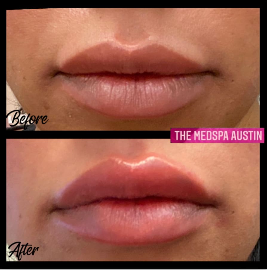 themedspaaustin-com logo